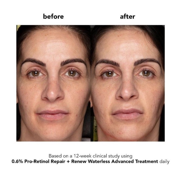 Boscia 0.6% Pro-Retinol Repair & Renew Waterless Advanced Treatment - Picture 4 of 10